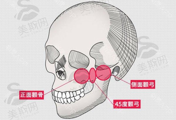 面部轮廓