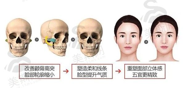 面部轮廓