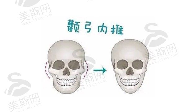 面部轮廓