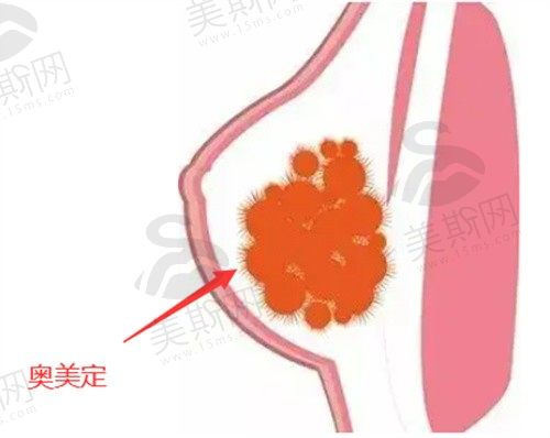 预约邓正军注射物取出要等多久?医生已开通网上挂号通道附联系方式