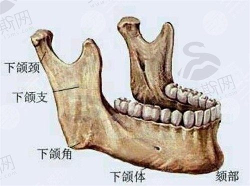 成都东篱医院李运峰做长曲线下颌角+外板3.88w元起，术后很自然