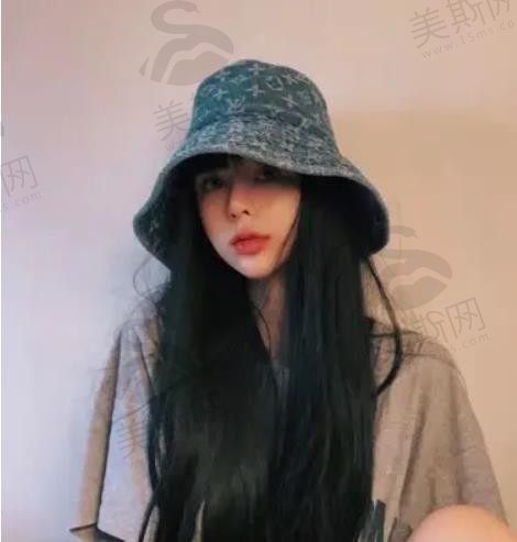 掌心的痣
