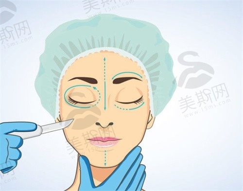 2024西安无痕去眼袋医院排行榜前十揭晓，顺便说下做眼袋技术好的医生