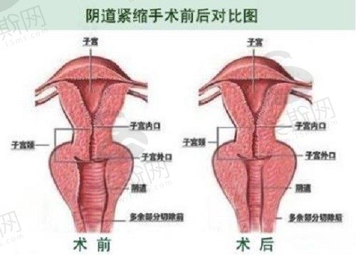 郑州哪家做私密整形好？郑州私密整形排名前十医院医生分享
