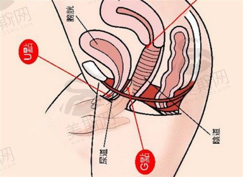 厦门私密整形去哪里做?有2024厦门私密整形较好的医院排名榜供参考