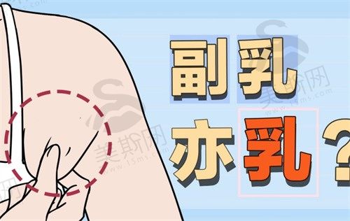 副乳是怎么来的,怎样才可以消除？可做手术快速有效消除方法大公开