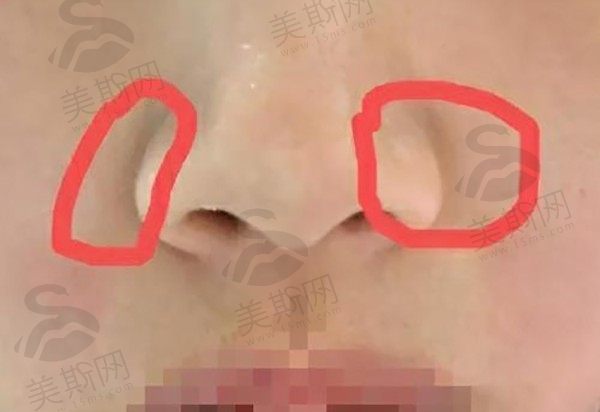 深圳福田区鼻翼缩小整形医院排行榜盘点，参考医院简介以及名医团队
