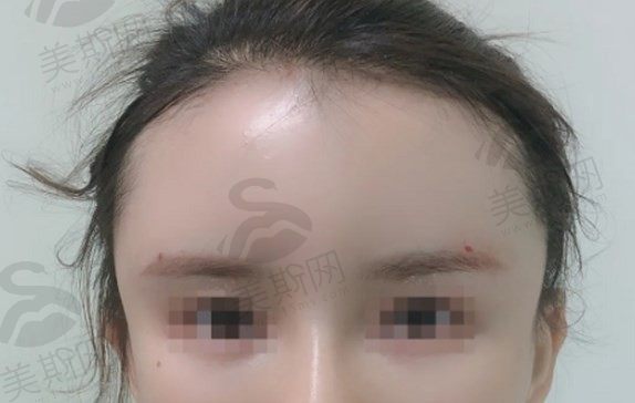 王阔远修复馒化怎么样？王阔远医生面部减容收费29800元起患者评价口碑好坐诊奥尔贝德