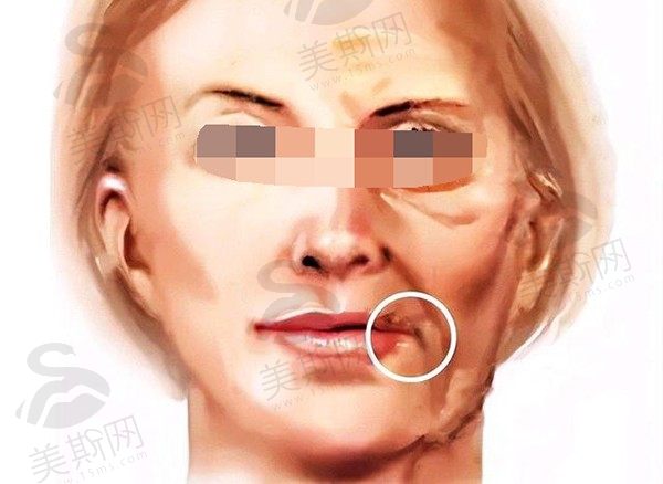 北京高亚东医生个人资料简介_擅长拉皮手术_坐诊北京华韩_口碑好预约方式全解析