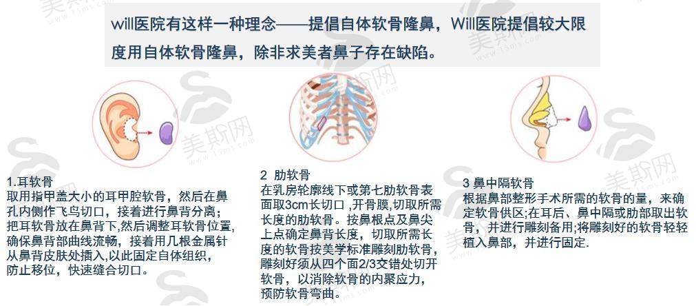 荔枝美：韩国will整形医院理念