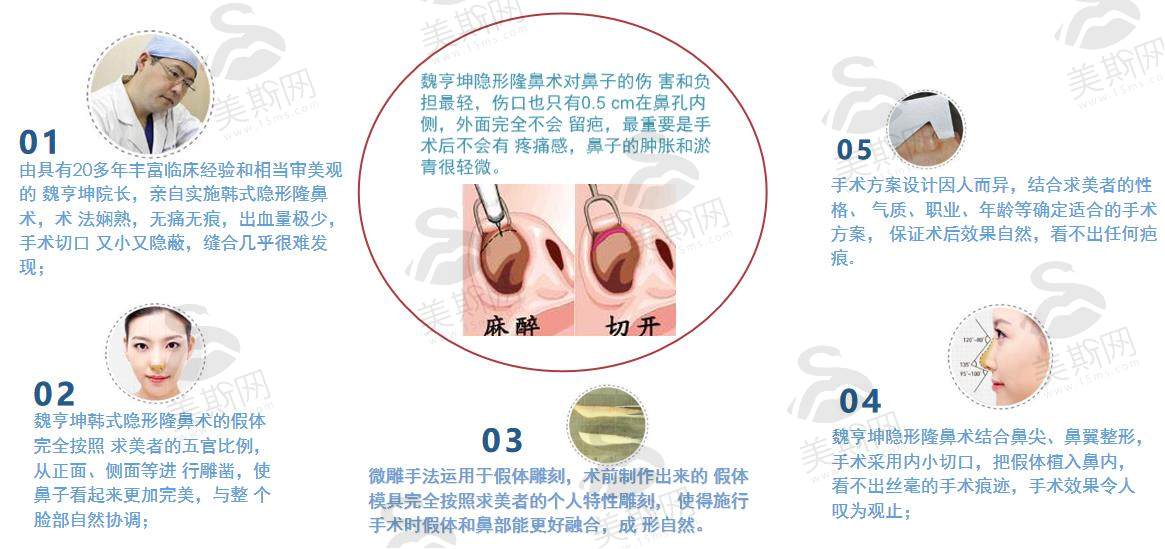 荔枝美：韩国will整形医院优势