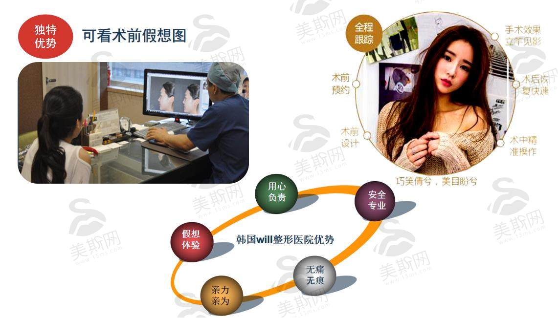 荔枝美：韩国will整形医院优势