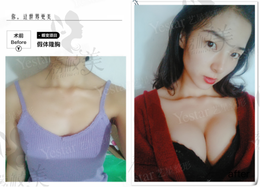 西安艺星医疗美容医院 院长窦玺<span style=