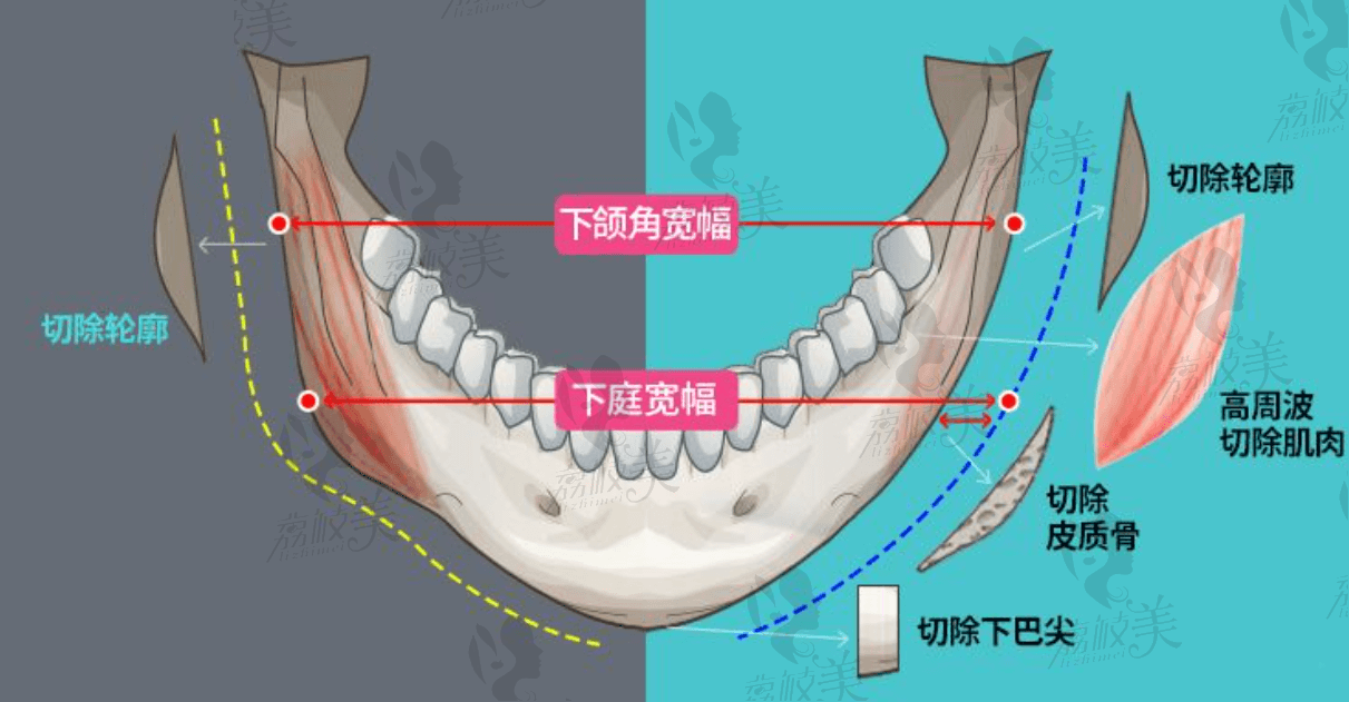 李志海特色技术及优势