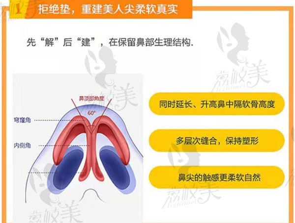 桂林时光潘延平肋骨隆鼻特色