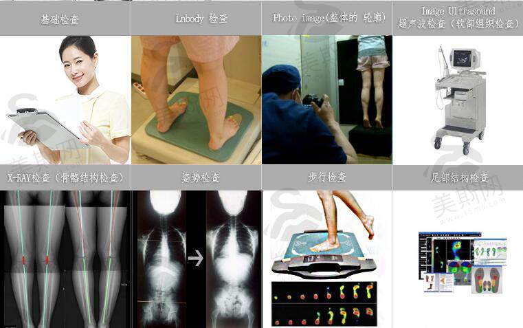 韩国JS美整形外科腿部矫正检查