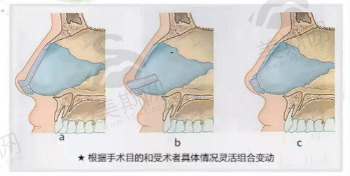 广东东莞圣之慧医疗美容医院特色项目