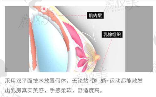 郑州壹加壹医疗王俊河医生隆胸好不好