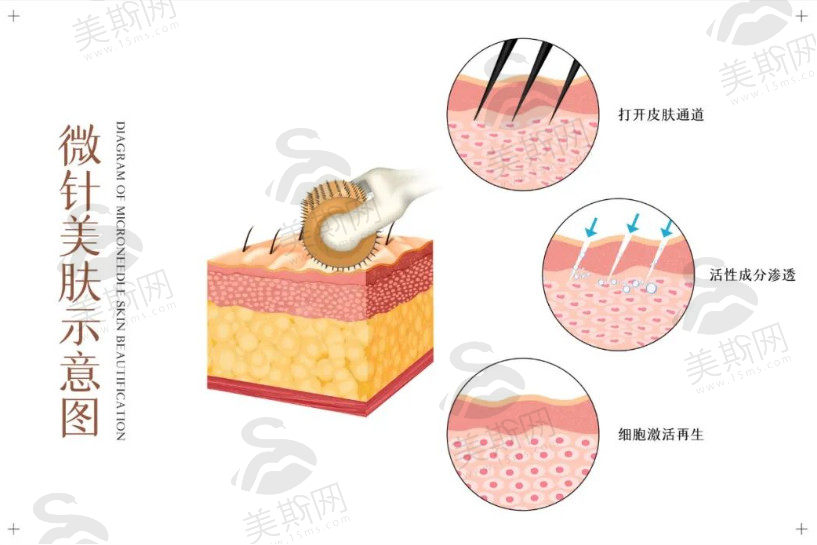 秋冬皮肤干燥，是时候带你了解一下<span style=