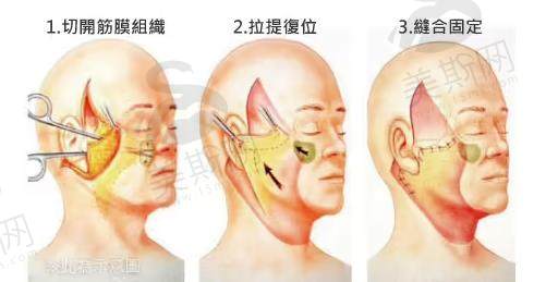 哈尔滨羽禅杨宇梓擅长项目