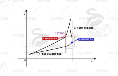 张笑天下颌角设计理念及技术优势