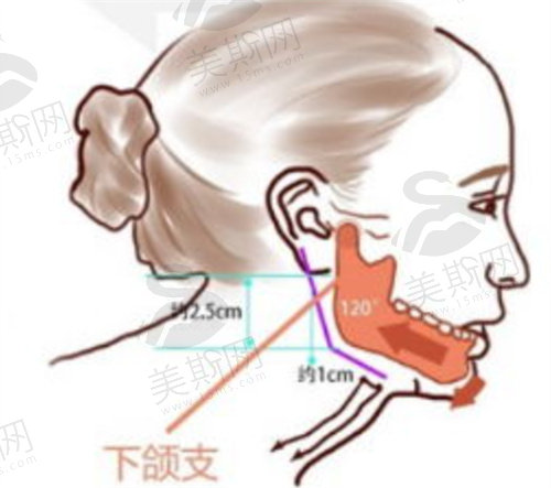 李志海医生磨骨手术风格