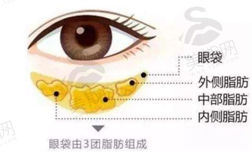 上海爱尚丽格杜园园做眼袋失败修复