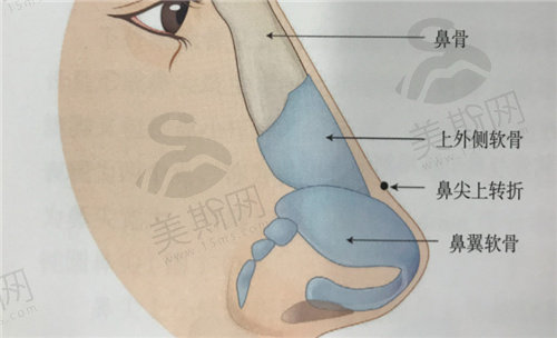 朱辉医生隆鼻技术好