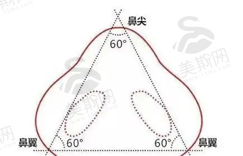 深圳艺星牛克辉医生做鼻子好不好