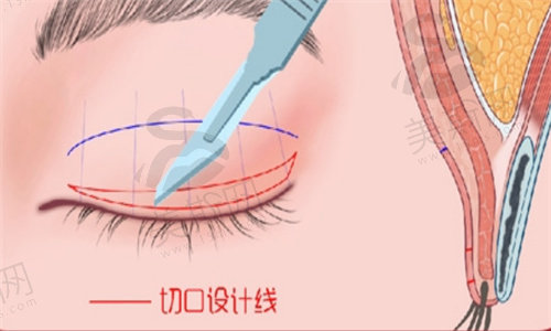 武汉韩辰王向阳阿尔法美眼综合怎么样