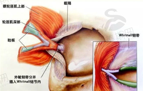 沈阳友谊整形医院双眼皮修复费用不贵