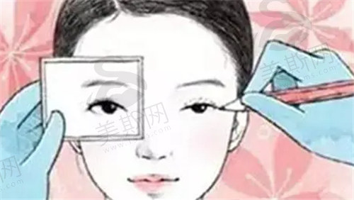 韩国梦想整形外科医院眼部整形价格表