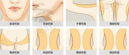 郑州欧华整形吸脂好不好？