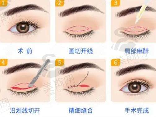 珍润王飞做眼睛怎么样 珍润王飞做眼睛怎么样