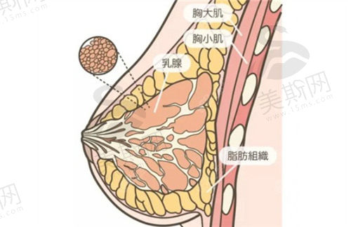 北京美莱做缩胸手术价格合理