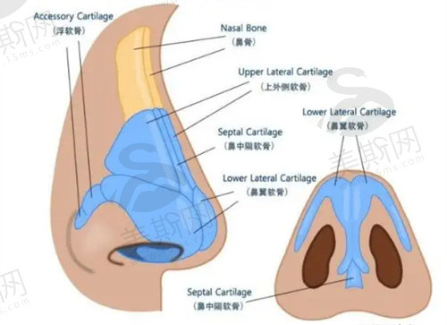 膨体隆鼻手术后会越来越矮吗？