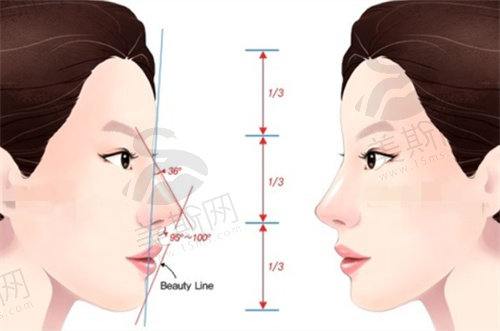 PEEK人工骨垫鼻基底和膨体垫鼻基底哪个好？