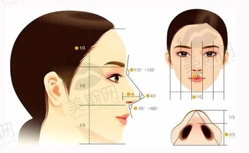 林金德鼻综合术前面诊体验