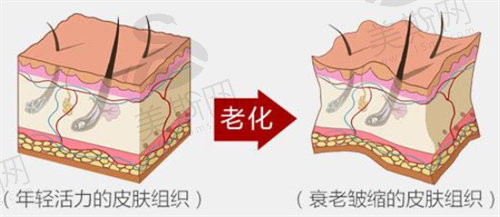 什么是钻石超塑？适合哪些人做？