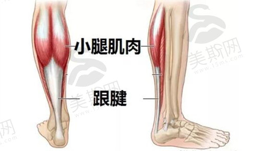 小腿抽脂好还是打瘦 腿针好呢？