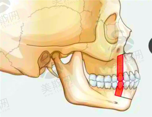何晋龙医生做正颌怎么样