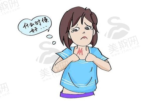 黑色烫伤疤痕的形成原因