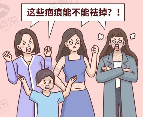 去除黑色烫伤疤痕的术后小技巧