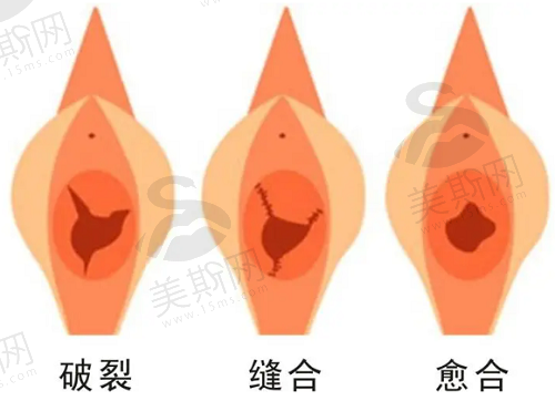 郑州中医药大学第 一附属医院私密科