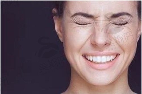 脸部皮肤松弛做什么整形好