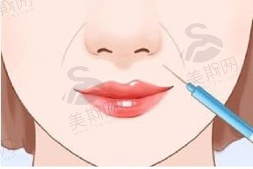 脸部皮肤松弛做什么整形好