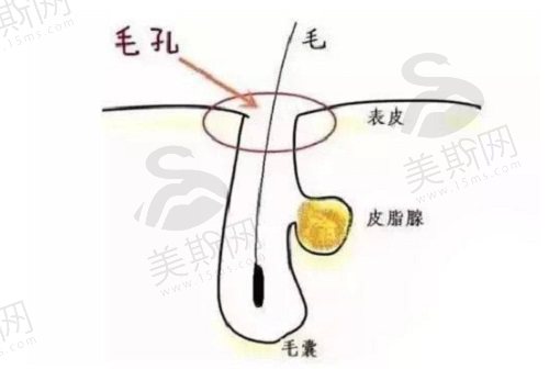 黑头到底怎么才能完全去掉