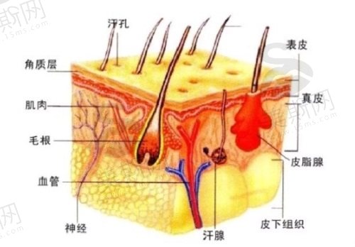 黑头到底怎么才能完全去掉