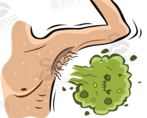 miradry清新微波治疗腋臭怎么样？