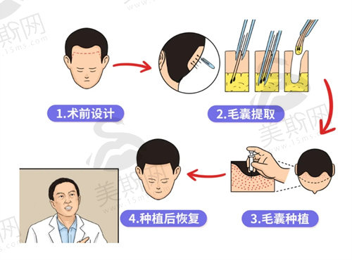 大连雍禾植发医院怎么样